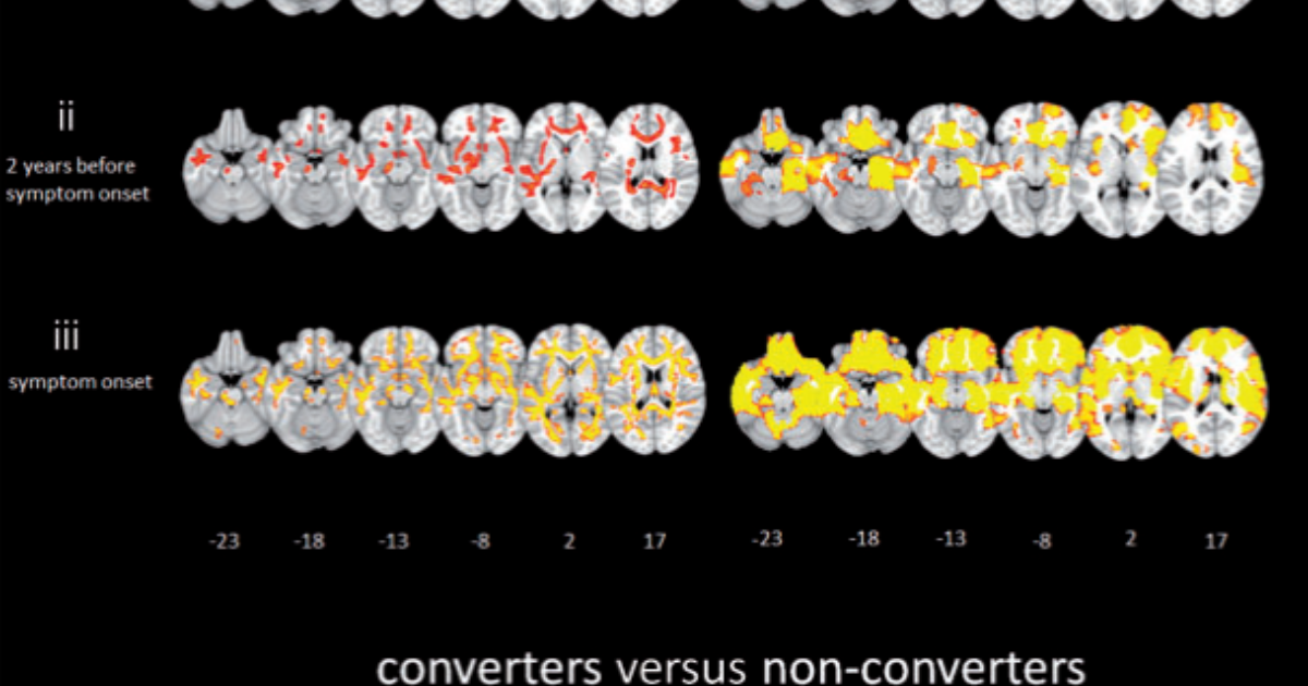 FTD-RisC - Alzheimercentrum Erasmus MC